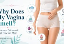 Why does my vagina smell infographic showing common vaginal odor types, including fishy, ammonia, onion, sweet, metallic, and warning signs