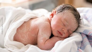 Newborn baby resting after birth with white vernix caseosa coating visible on the skin
